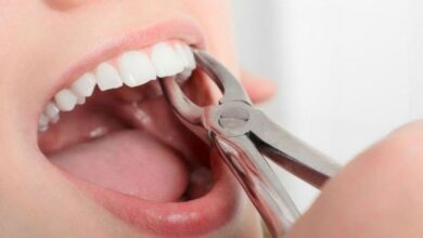 7 mẹo cầm máu sau khi nhổ răng hiệu quả, dễ làm tại nhà