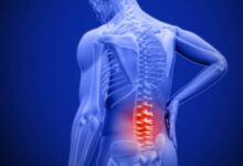 Đau lưng: Nguyên nhân, biến chứng và cách điều trị đau lưng hiệu quả