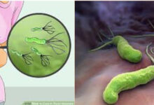 Vi khuẩn Helicobacter Pylori